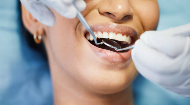 Best Emergency Wisdom Teeth Removal in Fort Riley, KS